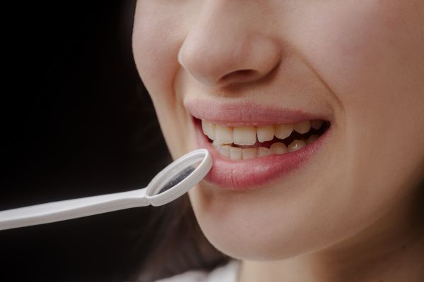 Signs You Are A Candidate For CEREC Crowns