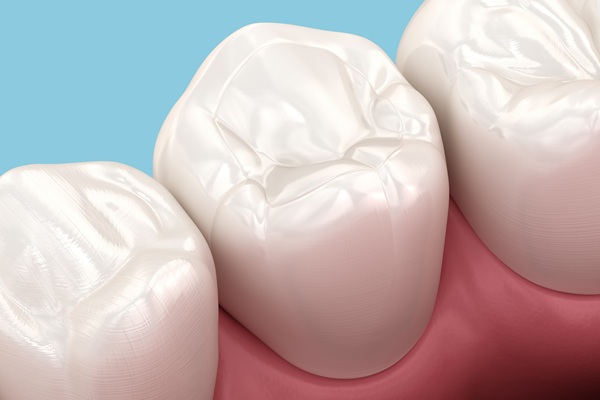 Things To Avoid After Getting A Dental Filling