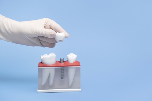 Why You Should Not Fear The Surgery To Get Tooth Implants
